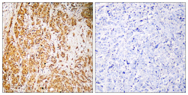 ZNF50 Antibody in Immunohistochemistry (Paraffin) (IHC (P))