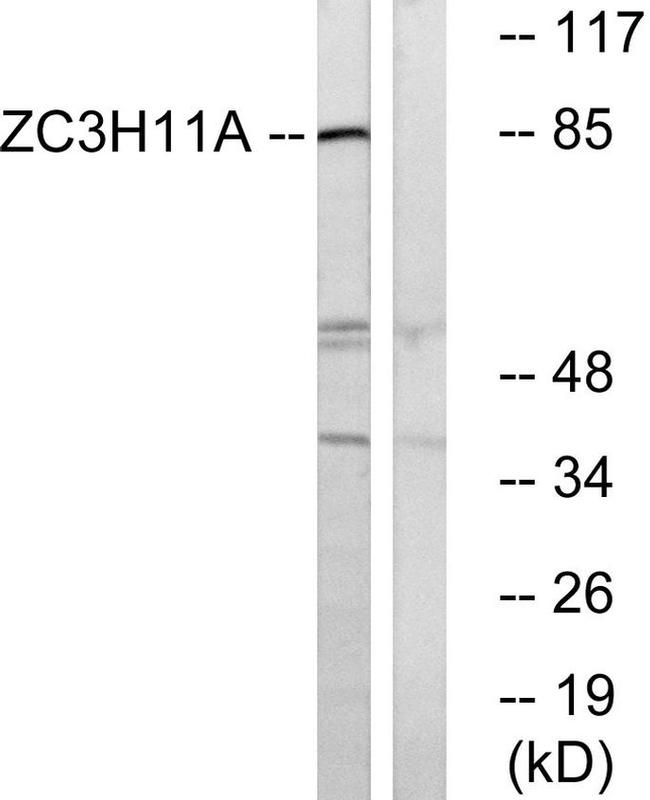 ZC3H11A Antibody in Western Blot (WB)