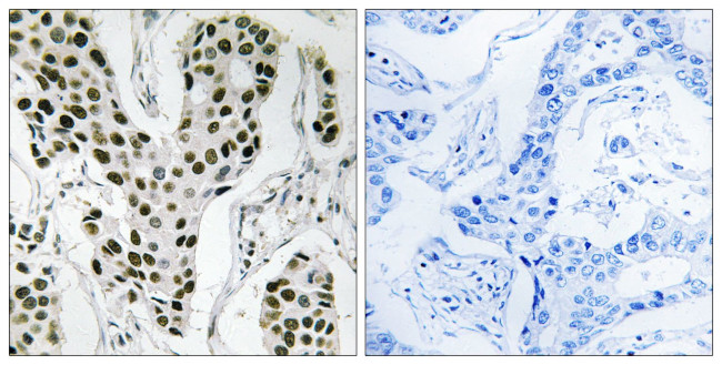 ZC3H4 Antibody in Immunohistochemistry (Paraffin) (IHC (P))