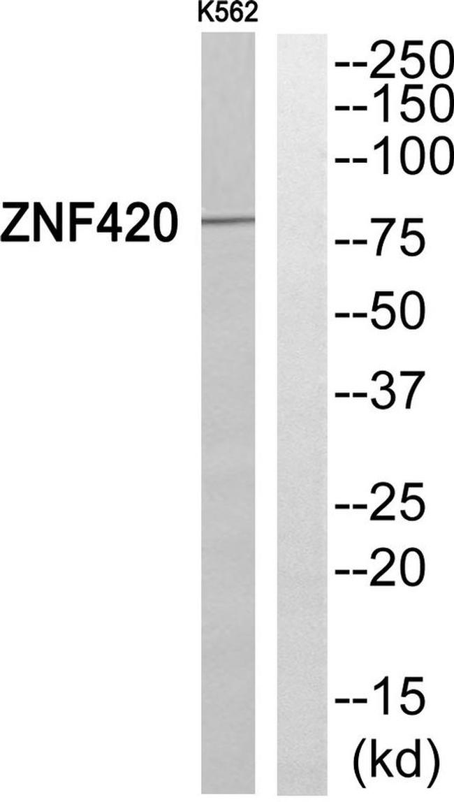 ZNF420 Antibody in Western Blot (WB)