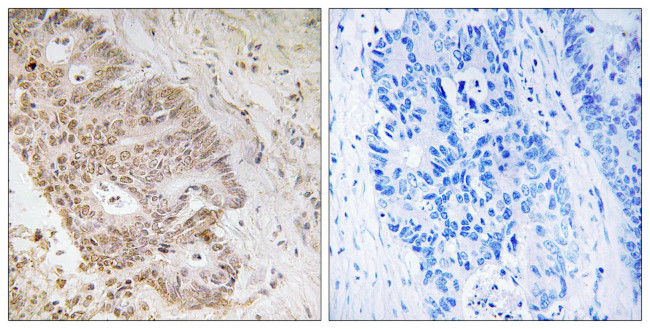 ZNF592 Antibody in Immunohistochemistry (Paraffin) (IHC (P))