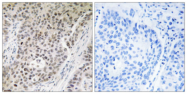 ZNF608 Antibody in Immunohistochemistry (Paraffin) (IHC (P))