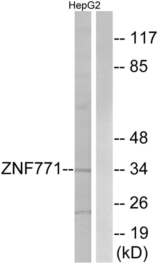 ZNF771 Antibody in Western Blot (WB)