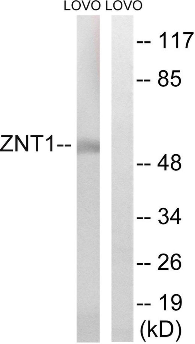 SLC30A1 Antibody in Western Blot (WB)