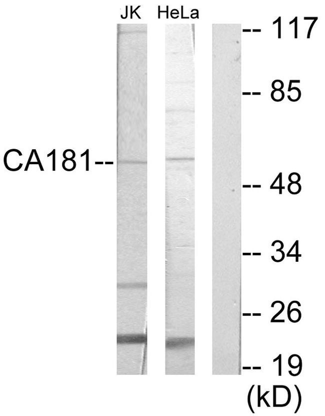 ZNHIT6 Antibody in Western Blot (WB)