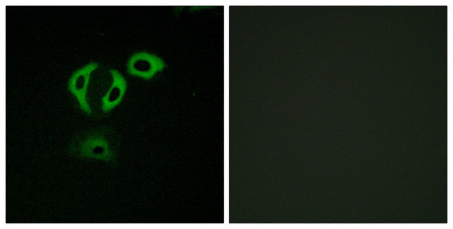 TACC3 Antibody in Immunocytochemistry (ICC/IF)