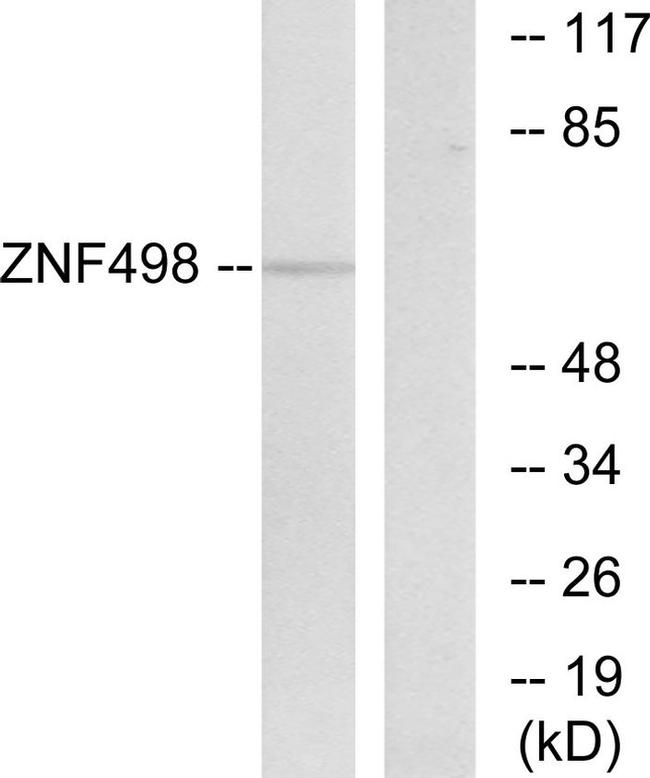 ZNF498 Antibody in Western Blot (WB)