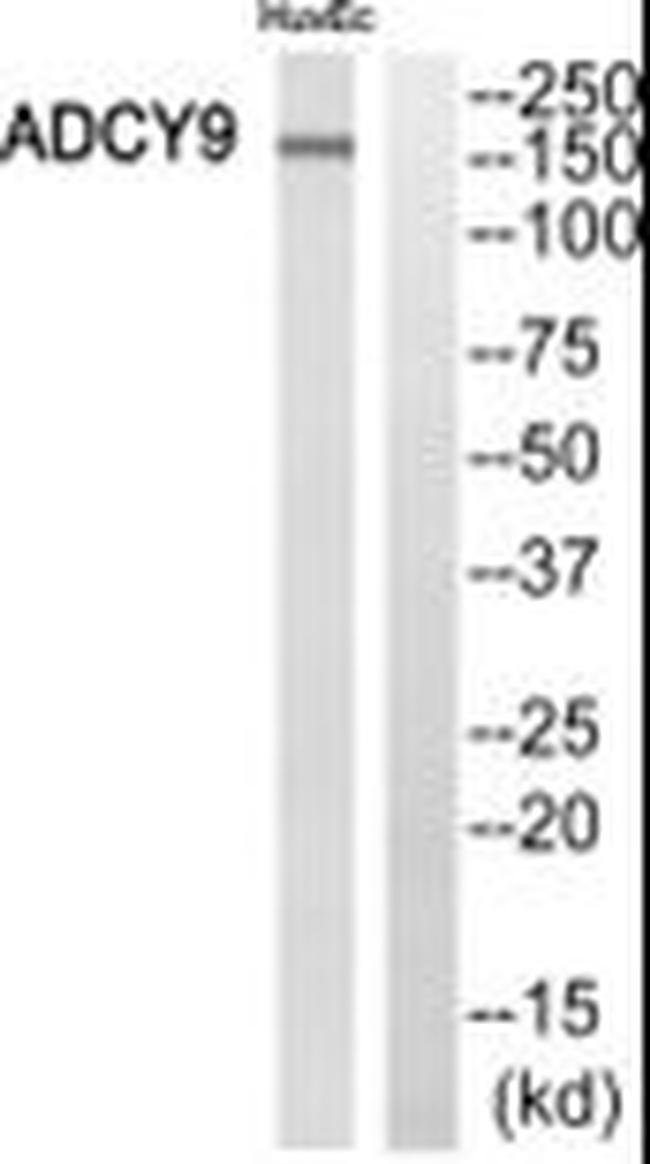 Adenylate Cyclase 9 Antibody in Western Blot (WB)