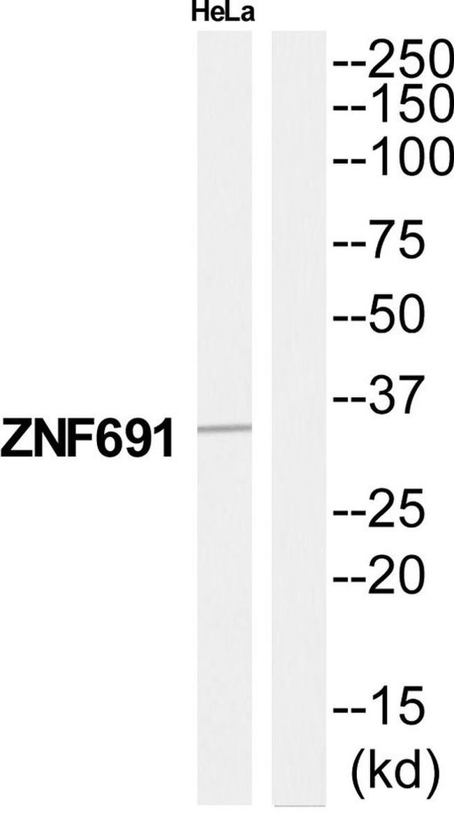 ZNF691 Antibody in Western Blot (WB)