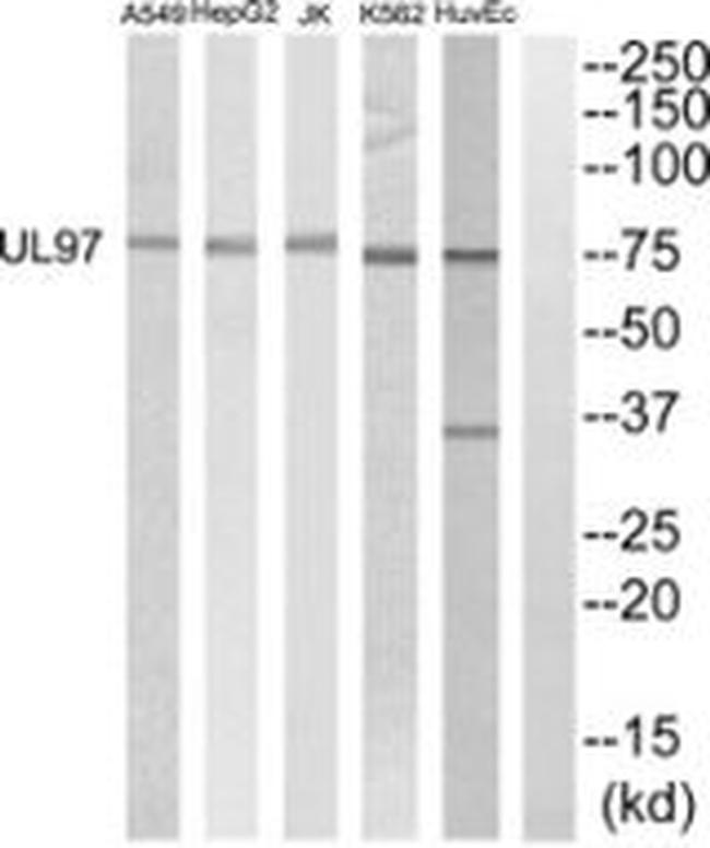 Cytomegalovirus UL97 Antibody in Western Blot (WB)