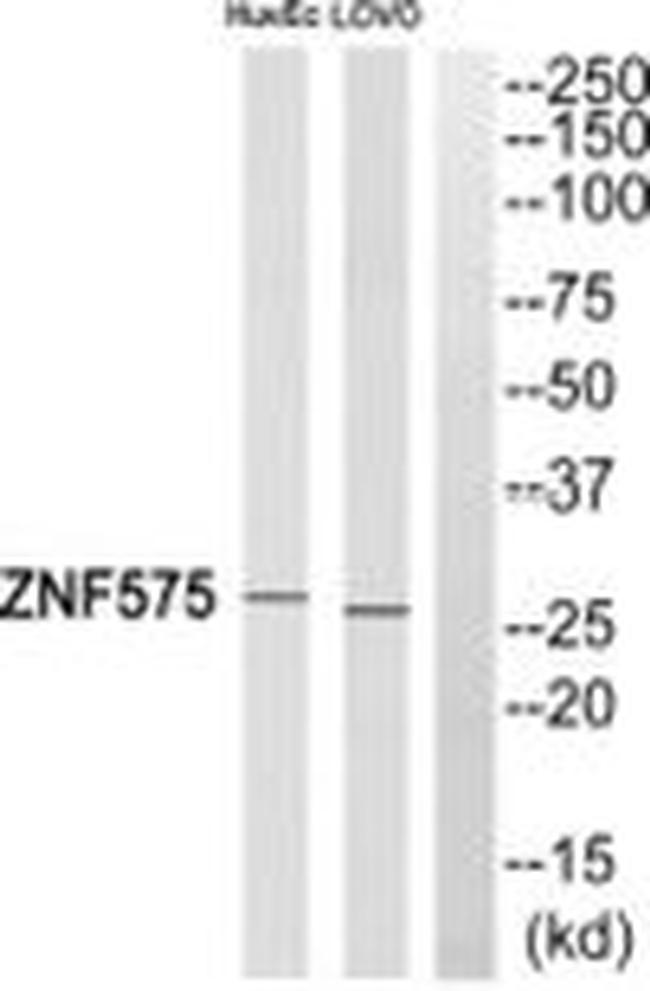 ZNF575 Antibody in Western Blot (WB)