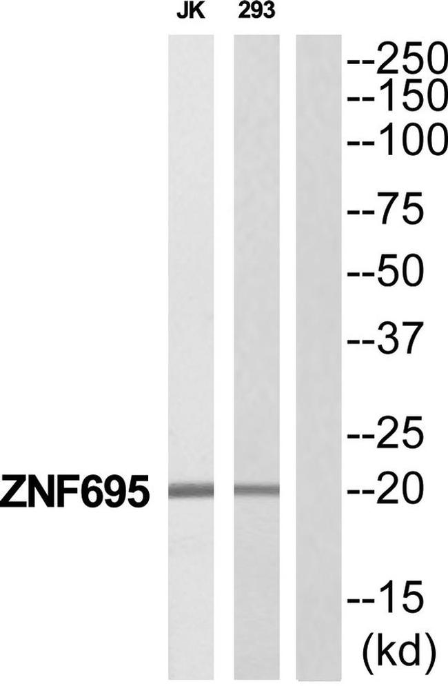 ZNF695 Antibody in Western Blot (WB)