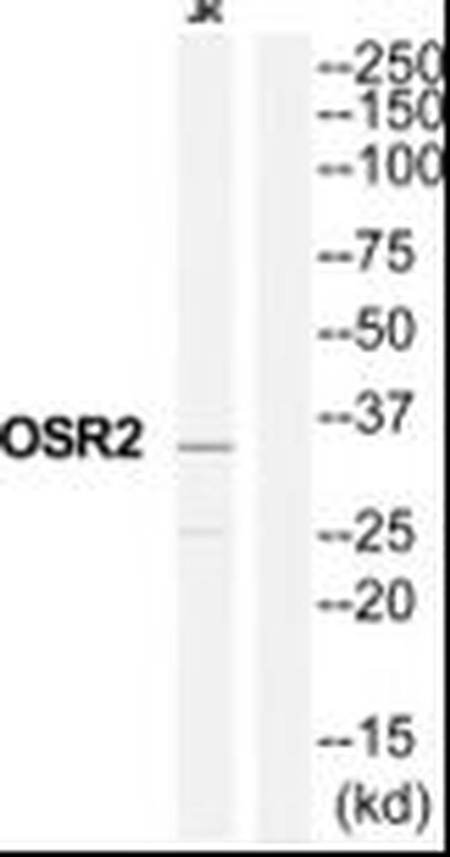 OSR2 Antibody in Western Blot (WB)