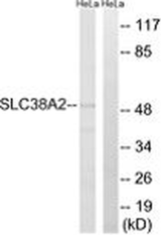 SLC38A2 Antibody in Western Blot (WB)