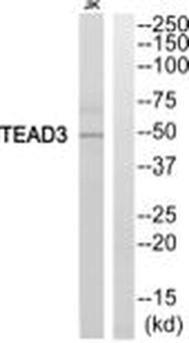 TEF5 Antibody in Western Blot (WB)
