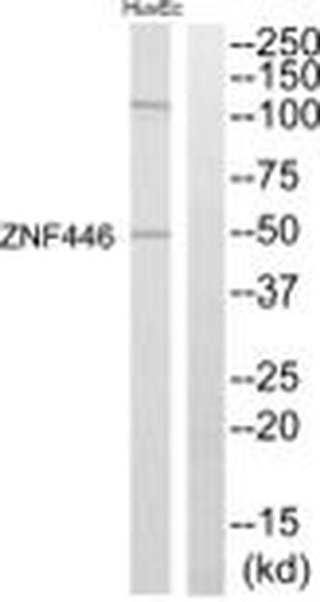 ZNF446 Antibody in Western Blot (WB)