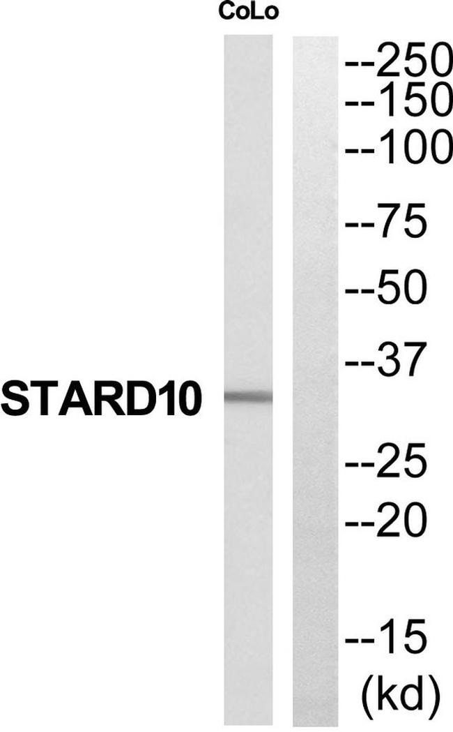 STARD10 Antibody in Western Blot (WB)