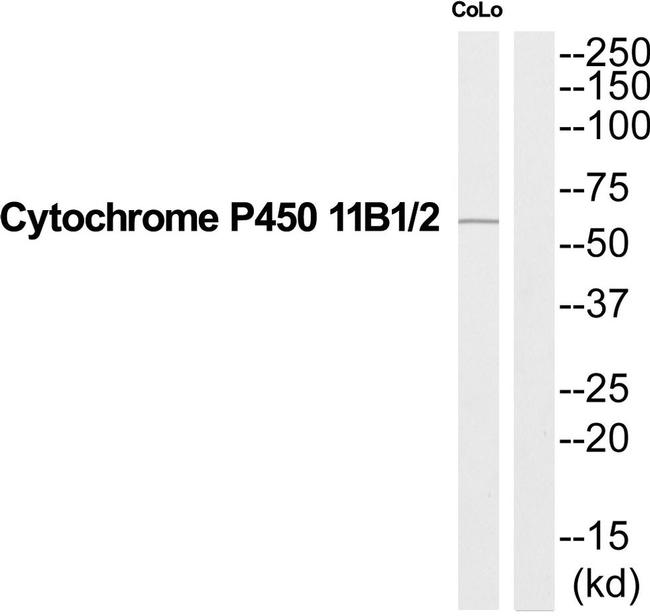 CYP11B1/CYP11B2 Antibody in Western Blot (WB)
