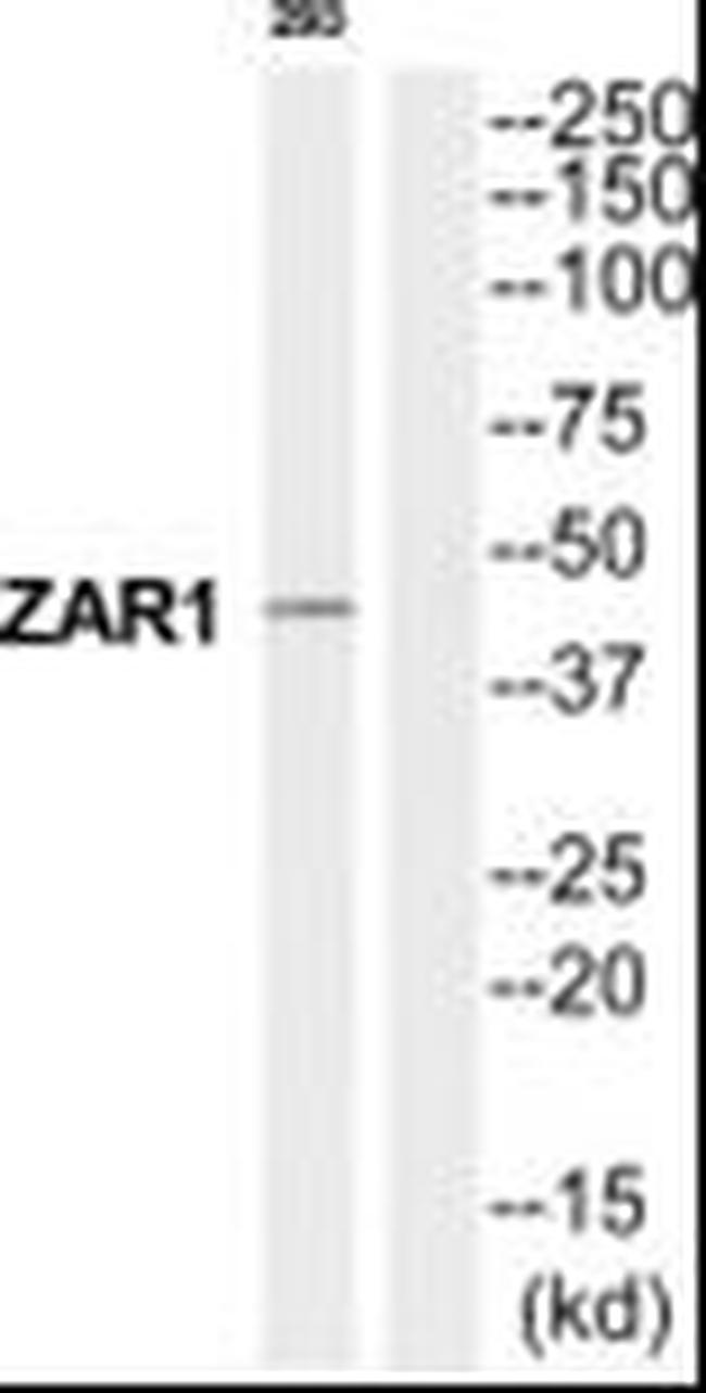 ZAR1 Antibody in Western Blot (WB)