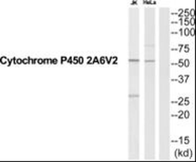 CYP2A6 Antibody in Western Blot (WB)