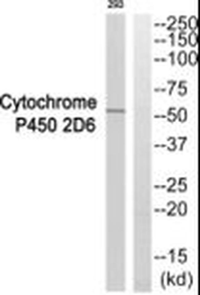 CYP2D6 Antibody in Western Blot (WB)