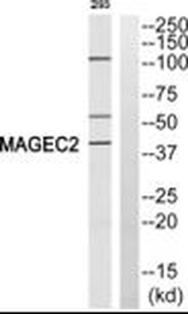 MAGEC2 Antibody in Western Blot (WB)