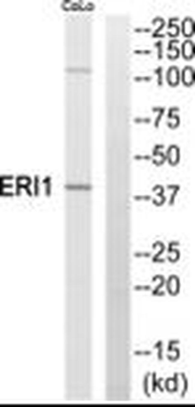 ERI1 Antibody in Western Blot (WB)