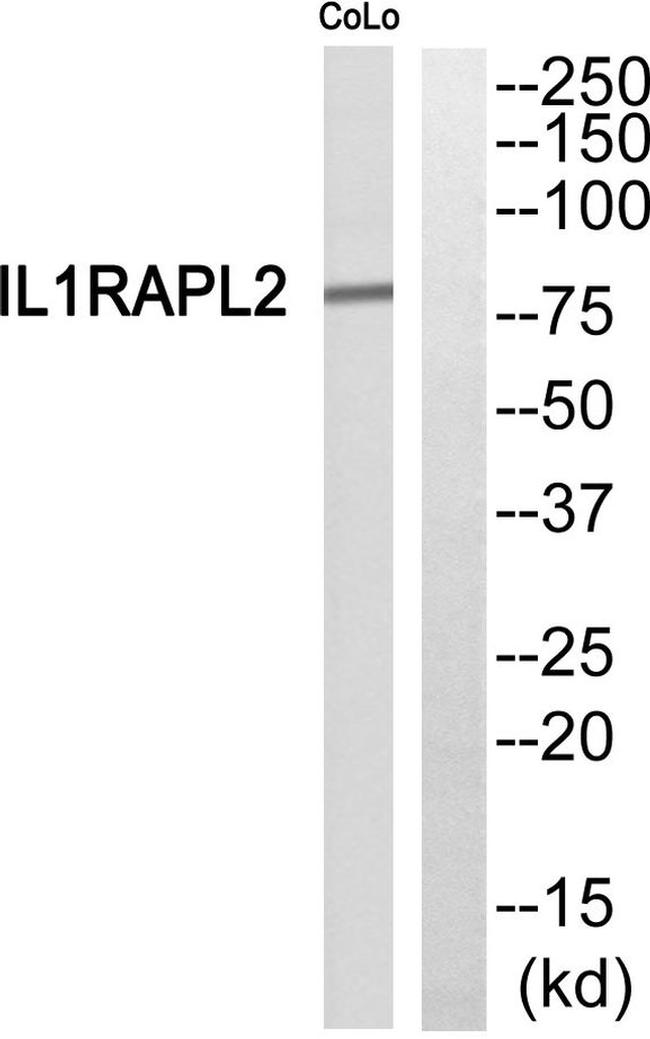 IL1RAPL2 Antibody in Western Blot (WB)