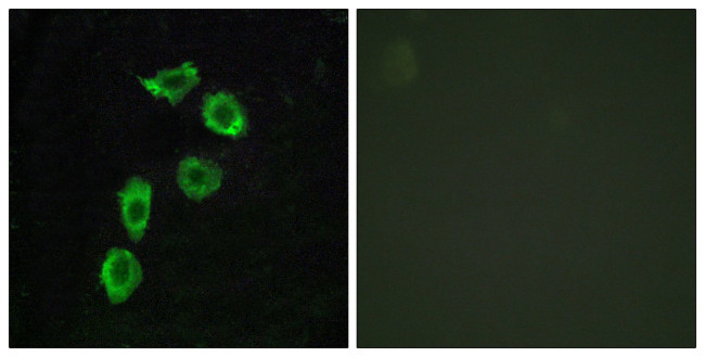 GPR123 Antibody in Immunocytochemistry (ICC/IF)