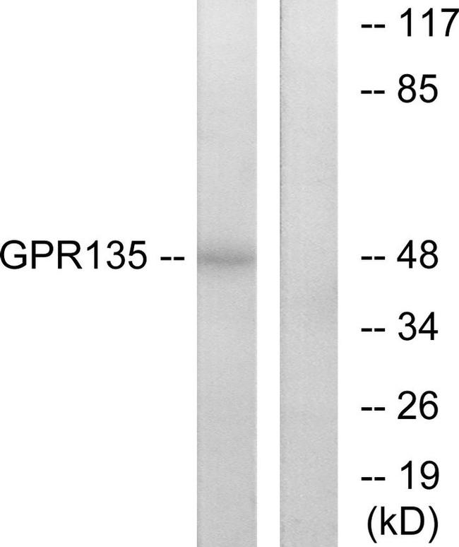 GPR135 Antibody in Western Blot (WB)