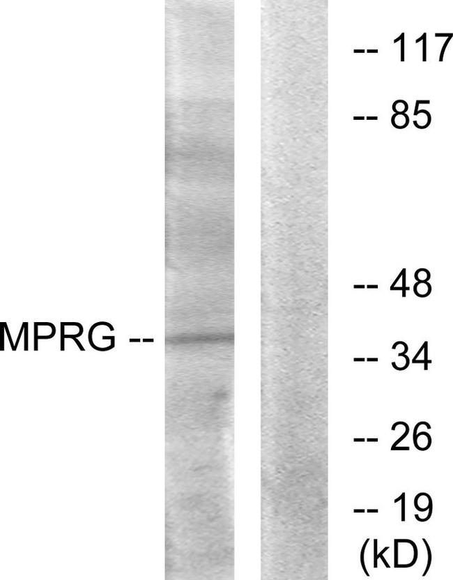 mPR gamma Antibody in Western Blot (WB)