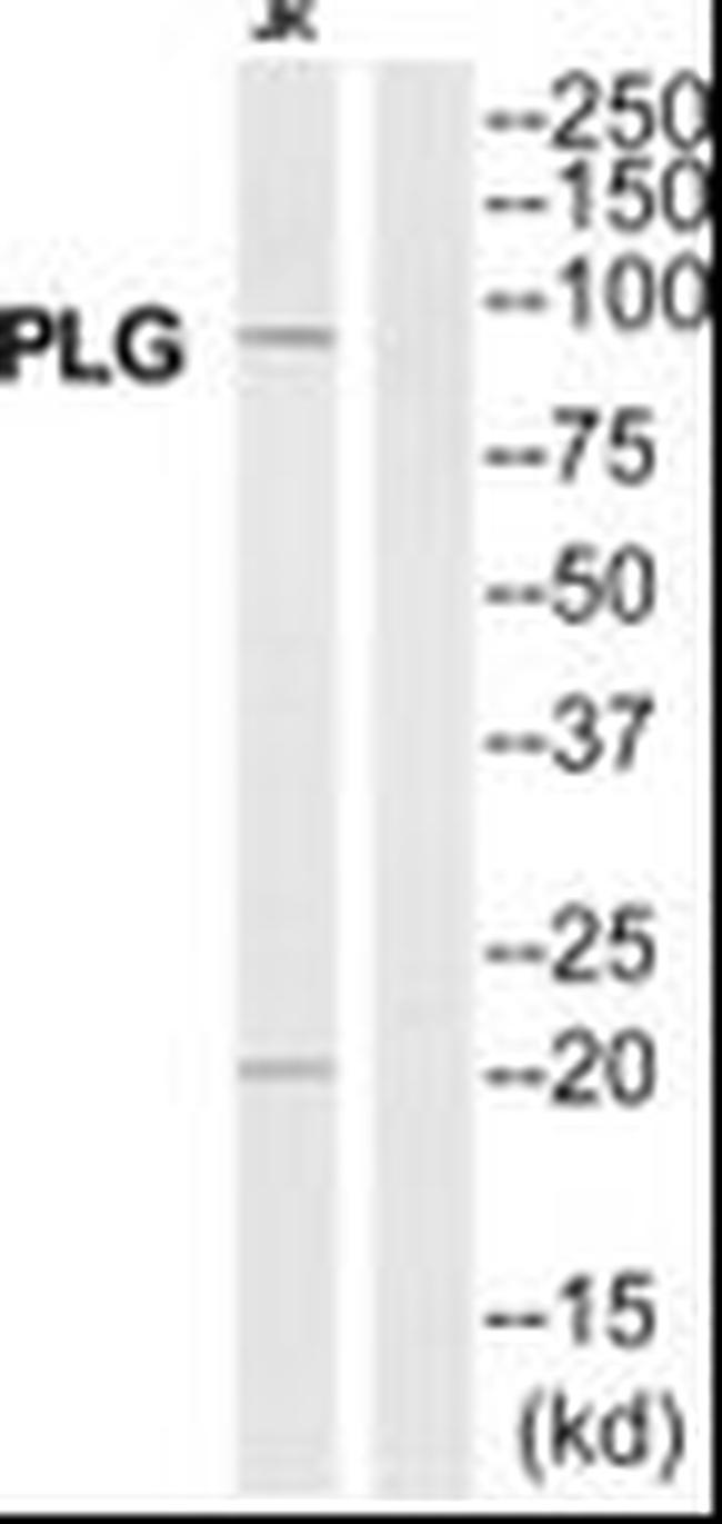 GPROPDR Antibody in Western Blot (WB)