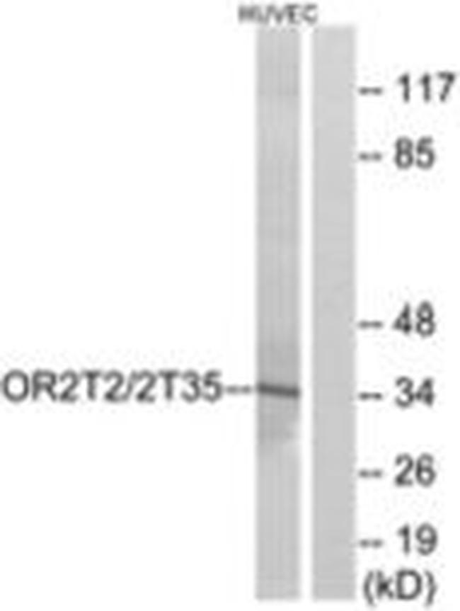 OR2T2/OR2T35 Antibody in Western Blot (WB)