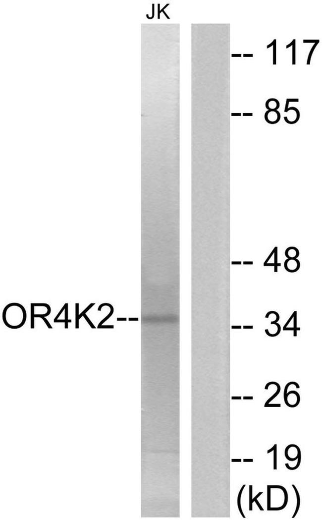 OR4K2 Antibody in Western Blot (WB)
