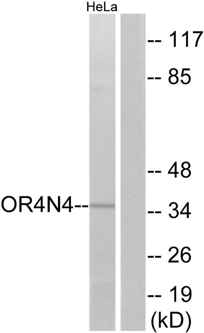 OR4N4 Antibody in Western Blot (WB)