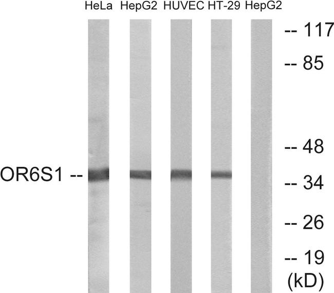OR6S1 Antibody in Western Blot (WB)