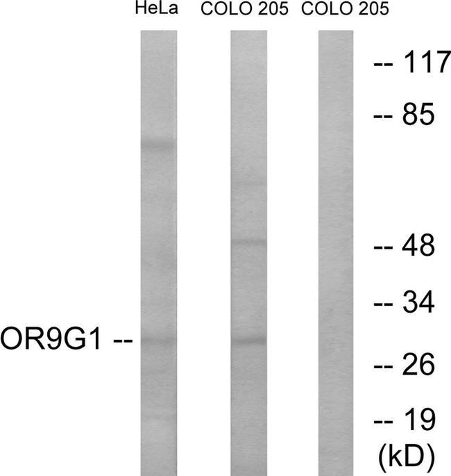 OR9G1 Antibody in Western Blot (WB)