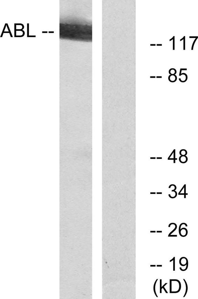 c-Abl Antibody in Western Blot (WB)