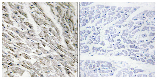 Phospho-CPI-17 (Thr38) Antibody in Immunohistochemistry (Paraffin) (IHC (P))