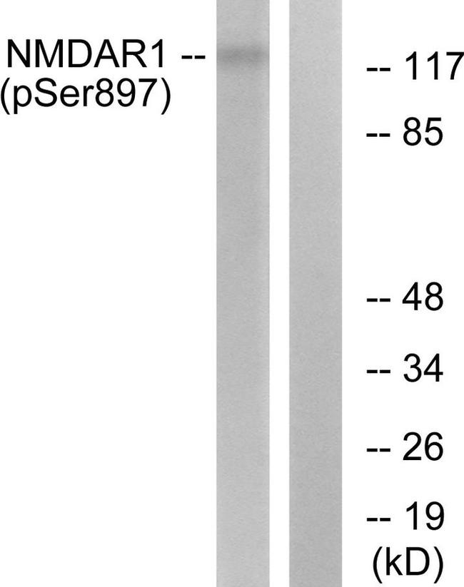 Phospho-NMDAR1 (Ser897) Antibody in Western Blot (WB)