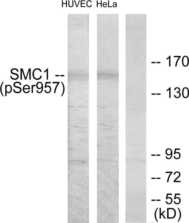 Phospho-SMC1 (Ser957) Antibody in Western Blot (WB)