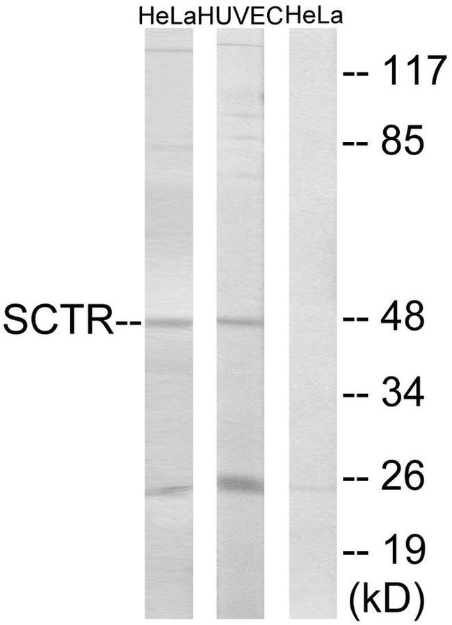 SCTR Antibody in Western Blot (WB)