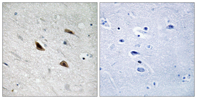 Phospho-beta Catenin (Tyr489) Antibody in Immunohistochemistry (Paraffin) (IHC (P))