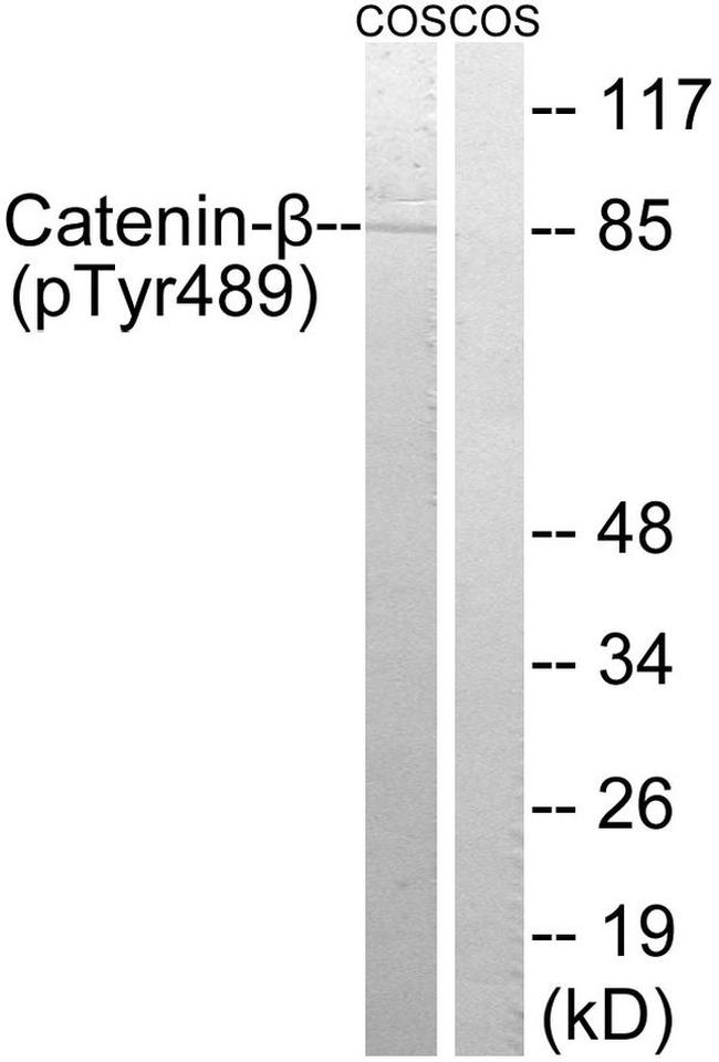 Phospho-beta Catenin (Tyr489) Antibody in Western Blot (WB)