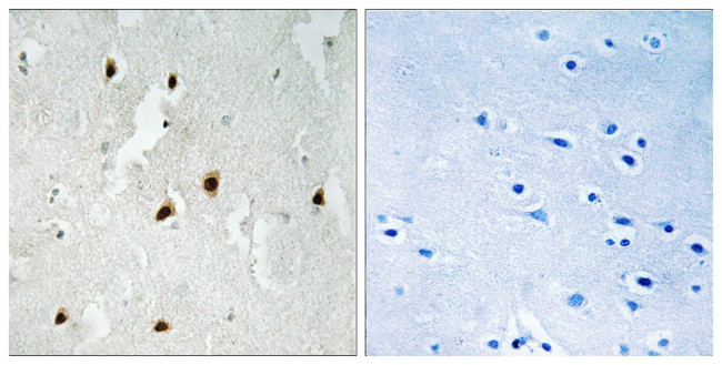 Phospho-FOXO4 (Ser262) Antibody in Immunohistochemistry (Paraffin) (IHC (P))