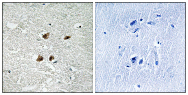 Phospho-HSF1 (Ser121) Antibody in Immunohistochemistry (Paraffin) (IHC (P))