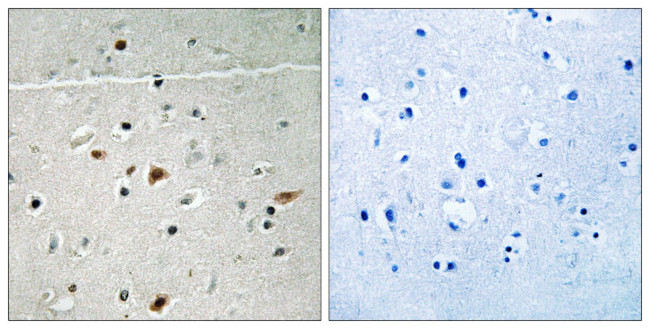 Phospho-LIMK2 (Ser283) Antibody in Immunohistochemistry (Paraffin) (IHC (P))