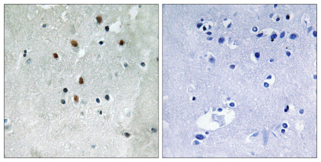 Phospho-SRF (Ser77) Antibody in Immunohistochemistry (Paraffin) (IHC (P))