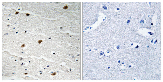 Phospho-AKT Pan (Tyr315, Tyr316, Tyr312) Antibody in Immunohistochemistry (Paraffin) (IHC (P))