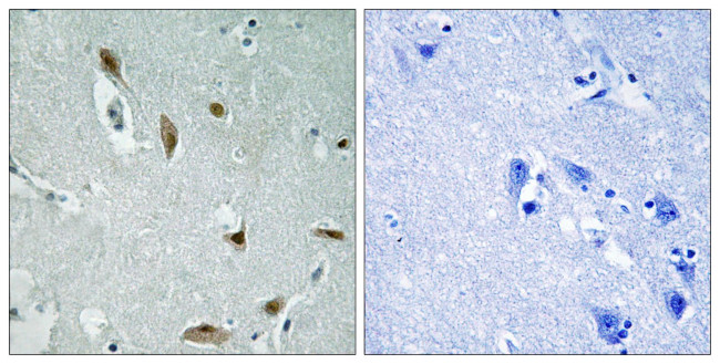 Phospho-AKT1/AKT3 (Tyr437, Tyr434) Antibody in Immunohistochemistry (Paraffin) (IHC (P))